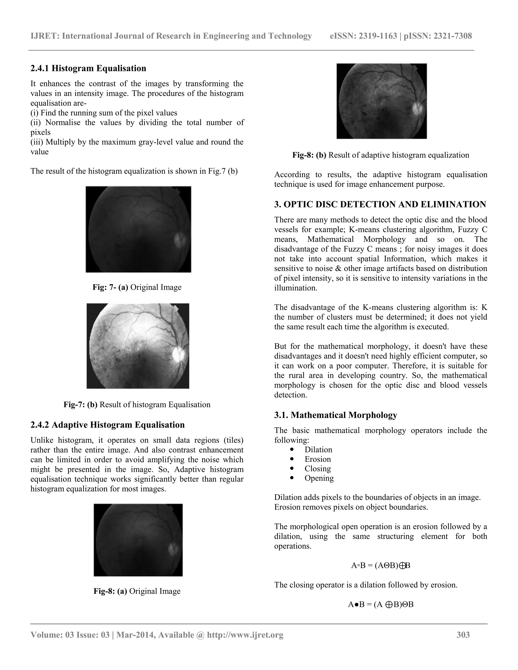 IJRET: International Journal of Research in Engineering and Technology eISSN: 2319-1163 | pISSN: 2321-7308
__________________________________________________________________________________________
Volume: 03 Issue: 03 | Mar-2014, Available @ http://www.ijret.org 303
2.4.1 Histogram Equalisation
It enhances the contrast of the images by transforming the
values in an intensity image. The procedures of the histogram
equalisation are-
(i) Find the running sum of the pixel values
(ii) Normalise the values by dividing the total number of
pixels
(iii) Multiply by the maximum gray-level value and round the
value
The result of the histogram equalization is shown in Fig.7 (b)
Fig: 7- (a) Original Image
Fig-7: (b) Result of histogram Equalisation
2.4.2 Adaptive Histogram Equalisation
Unlike histogram, it operates on small data regions (tiles)
rather than the entire image. And also contrast enhancement
can be limited in order to avoid amplifying the noise which
might be presented in the image. So, Adaptive histogram
equalisation technique works significantly better than regular
histogram equalization for most images.
Fig-8: (a) Original Image
Fig-8: (b) Result of adaptive histogram equalization
According to results, the adaptive histogram equalisation
technique is used for image enhancement purpose.
3. OPTIC DISC DETECTION AND ELIMINATION
There are many methods to detect the optic disc and the blood
vessels for example; K-means clustering algorithm, Fuzzy C
means, Mathematical Morphology and so on. The
disadvantage of the Fuzzy C means ; for noisy images it does
not take into account spatial Information, which makes it
sensitive to noise & other image artifacts based on distribution
of pixel intensity, so it is sensitive to intensity variations in the
illumination.
The disadvantage of the K-means clustering algorithm is: K
the number of clusters must be determined; it does not yield
the same result each time the algorithm is executed.
But for the mathematical morphology, it doesn't have these
disadvantages and it doesn't need highly efficient computer, so
it can work on a poor computer. Therefore, it is suitable for
the rural area in developing country. So, the mathematical
morphology is chosen for the optic disc and blood vessels
detection.
3.1. Mathematical Morphology
The basic mathematical morphology operators include the
following:
 Dilation
 Erosion
 Closing
 Opening
Dilation adds pixels to the boundaries of objects in an image.
Erosion removes pixels on object boundaries.
The morphological open operation is an erosion followed by a
dilation, using the same structuring element for both
operations.
A◦B = (AΘB)⊕B
The closing operator is a dilation followed by erosion.
A●B = (A ⊕B)ΘB
 