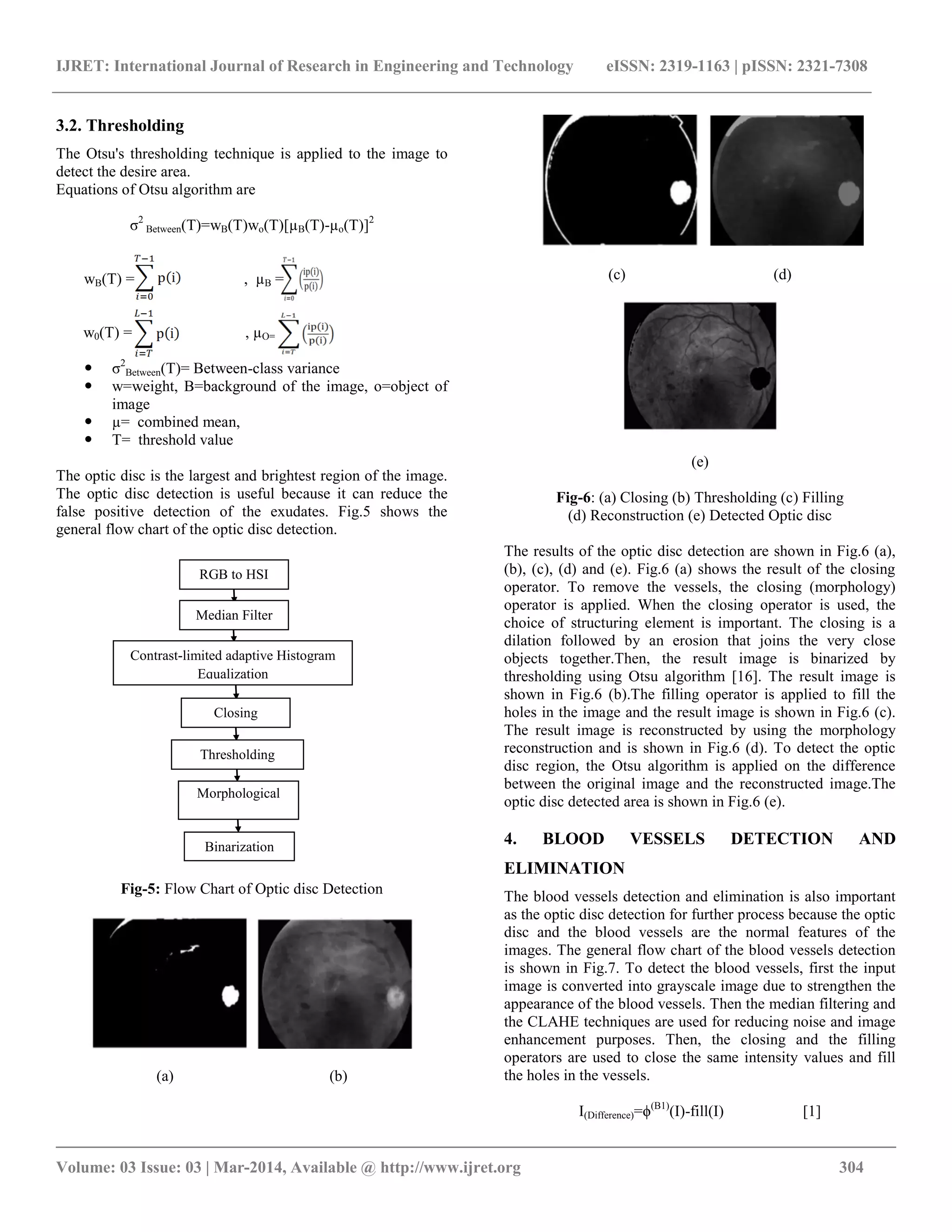 IJRET: International Journal of Research in Engineering and Technology eISSN: 2319-1163 | pISSN: 2321-7308
__________________________________________________________________________________________
Volume: 03 Issue: 03 | Mar-2014, Available @ http://www.ijret.org 304
3.2. Thresholding
The Otsu's thresholding technique is applied to the image to
detect the desire area.
Equations of Otsu algorithm are
σ2
Between(T)=wB(T)wo(T)[µB(T)-µo(T)]2
wB(T) = , µB =
w0(T) = , µO=
 σ2
Between(T)= Between-class variance
 w=weight, B=background of the image, o=object of
image
 µ= combined mean,
 T= threshold value
The optic disc is the largest and brightest region of the image.
The optic disc detection is useful because it can reduce the
false positive detection of the exudates. Fig.5 shows the
general flow chart of the optic disc detection.
Fig-5: Flow Chart of Optic disc Detection
(a) (b)
(c) (d)
(e)
Fig-6: (a) Closing (b) Thresholding (c) Filling
(d) Reconstruction (e) Detected Optic disc
The results of the optic disc detection are shown in Fig.6 (a),
(b), (c), (d) and (e). Fig.6 (a) shows the result of the closing
operator. To remove the vessels, the closing (morphology)
operator is applied. When the closing operator is used, the
choice of structuring element is important. The closing is a
dilation followed by an erosion that joins the very close
objects together.Then, the result image is binarized by
thresholding using Otsu algorithm [16]. The result image is
shown in Fig.6 (b).The filling operator is applied to fill the
holes in the image and the result image is shown in Fig.6 (c).
The result image is reconstructed by using the morphology
reconstruction and is shown in Fig.6 (d). To detect the optic
disc region, the Otsu algorithm is applied on the difference
between the original image and the reconstructed image.The
optic disc detected area is shown in Fig.6 (e).
4. BLOOD VESSELS DETECTION AND
ELIMINATION
The blood vessels detection and elimination is also important
as the optic disc detection for further process because the optic
disc and the blood vessels are the normal features of the
images. The general flow chart of the blood vessels detection
is shown in Fig.7. To detect the blood vessels, first the input
image is converted into grayscale image due to strengthen the
appearance of the blood vessels. Then the median filtering and
the CLAHE techniques are used for reducing noise and image
enhancement purposes. Then, the closing and the filling
operators are used to close the same intensity values and fill
the holes in the vessels.
I(Difference)=ϕ(B1)
(I)-fill(I) [1]
RGB to HSI
Median Filter
Contrast-limited adaptive Histogram
Equalization
histogram equalizationClosing
Thresholding
Morphological
reconstruction
Binarization
 