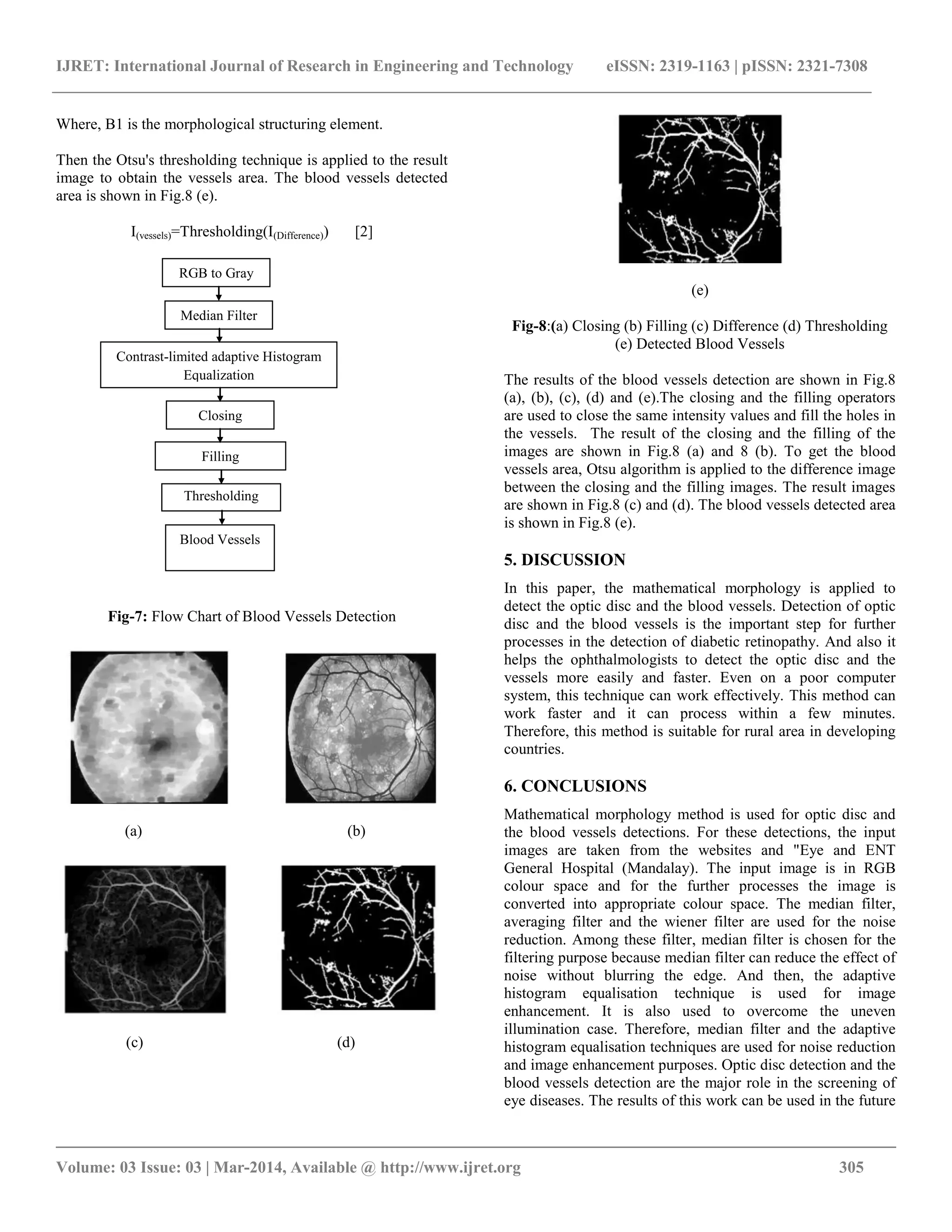 IJRET: International Journal of Research in Engineering and Technology eISSN: 2319-1163 | pISSN: 2321-7308
__________________________________________________________________________________________
Volume: 03 Issue: 03 | Mar-2014, Available @ http://www.ijret.org 305
Where, B1 is the morphological structuring element.
Then the Otsu's thresholding technique is applied to the result
image to obtain the vessels area. The blood vessels detected
area is shown in Fig.8 (e).
I(vessels)=Thresholding(I(Difference)) [2]
Fig-7: Flow Chart of Blood Vessels Detection
(a) (b)
(c) (d)
(e)
Fig-8:(a) Closing (b) Filling (c) Difference (d) Thresholding
(e) Detected Blood Vessels
The results of the blood vessels detection are shown in Fig.8
(a), (b), (c), (d) and (e).The closing and the filling operators
are used to close the same intensity values and fill the holes in
the vessels. The result of the closing and the filling of the
images are shown in Fig.8 (a) and 8 (b). To get the blood
vessels area, Otsu algorithm is applied to the difference image
between the closing and the filling images. The result images
are shown in Fig.8 (c) and (d). The blood vessels detected area
is shown in Fig.8 (e).
5. DISCUSSION
In this paper, the mathematical morphology is applied to
detect the optic disc and the blood vessels. Detection of optic
disc and the blood vessels is the important step for further
processes in the detection of diabetic retinopathy. And also it
helps the ophthalmologists to detect the optic disc and the
vessels more easily and faster. Even on a poor computer
system, this technique can work effectively. This method can
work faster and it can process within a few minutes.
Therefore, this method is suitable for rural area in developing
countries.
6. CONCLUSIONS
Mathematical morphology method is used for optic disc and
the blood vessels detections. For these detections, the input
images are taken from the websites and "Eye and ENT
General Hospital (Mandalay). The input image is in RGB
colour space and for the further processes the image is
converted into appropriate colour space. The median filter,
averaging filter and the wiener filter are used for the noise
reduction. Among these filter, median filter is chosen for the
filtering purpose because median filter can reduce the effect of
noise without blurring the edge. And then, the adaptive
histogram equalisation technique is used for image
enhancement. It is also used to overcome the uneven
illumination case. Therefore, median filter and the adaptive
histogram equalisation techniques are used for noise reduction
and image enhancement purposes. Optic disc detection and the
blood vessels detection are the major role in the screening of
eye diseases. The results of this work can be used in the future
RGB to Gray
Median Filter
Contrast-limited adaptive Histogram
Equalization
histogram equalizationClosing
Filling
Thresholding
Blood Vessels
Detection
 