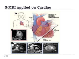 5-MRI applied on Cardiac
18
 