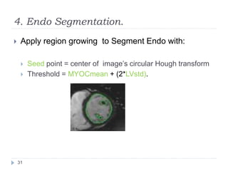 4. Endo Segmentation.
 Apply region growing to Segment Endo with:
 Seed point = center of image’s circular Hough transform
 Threshold = MYOCmean + (2*LVstd).
31
 
