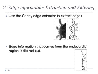 2. Edge Information Extraction and Filtering.
 Use the Canny edge extractor to extract edges.
 Edge information that comes from the endocardial
region is filtered out.
38
 