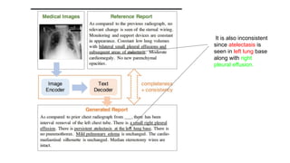 Automatic Radiology Report Generation.pdf