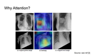 Automatic Radiology Report Generation.pdf
