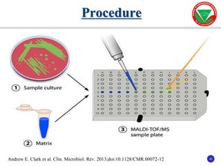 43
43
Procedure
Andrew E. Clark et al. Clin. Microbiol. Rev. 2013;doi:10.1128/CMR.00072-12
 