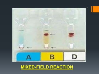 MIXED-FIELD REACTION
27
 