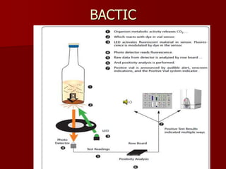Automation in microbiology, changing concept and defeating challenges ...
