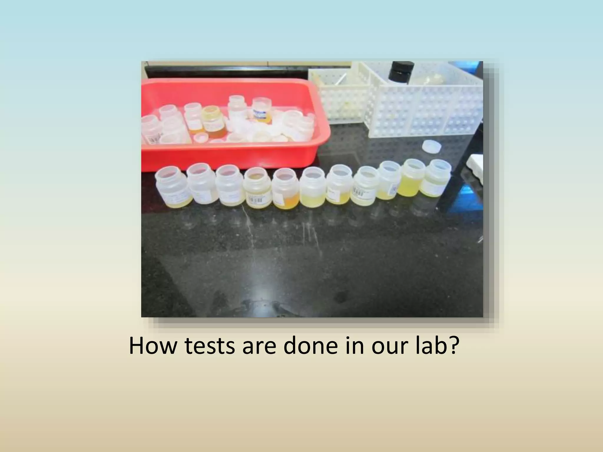How tests are done in our lab?
 