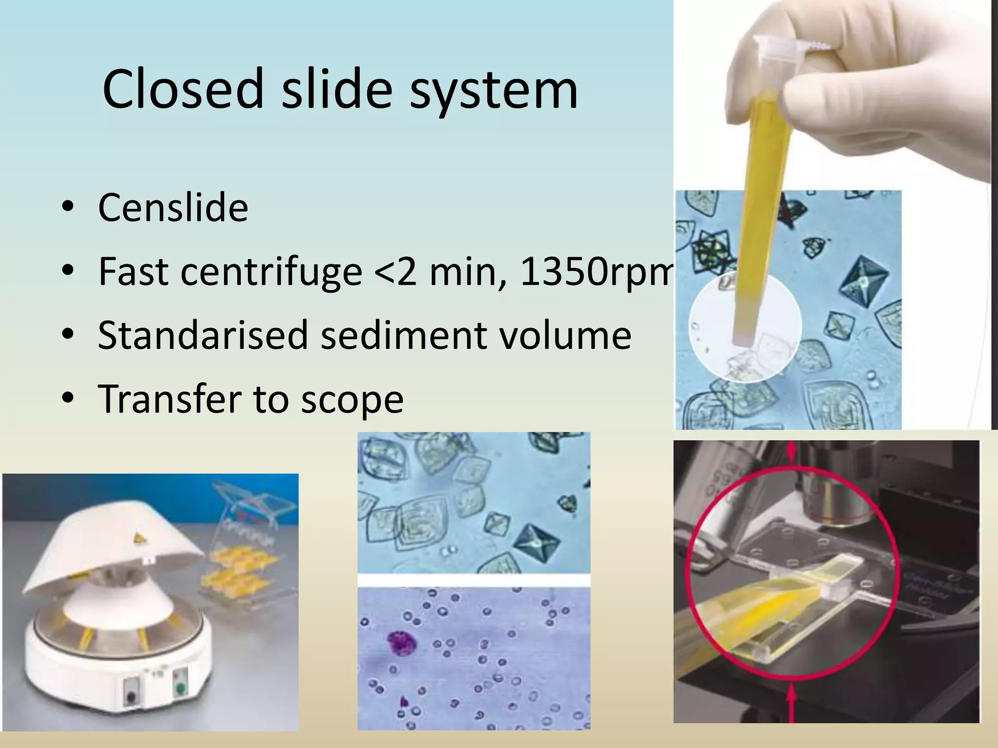 Closed slide system
• Censlide
• Fast centrifuge <2 min, 1350rpm
• Standarised sediment volume
• Transfer to scope
 