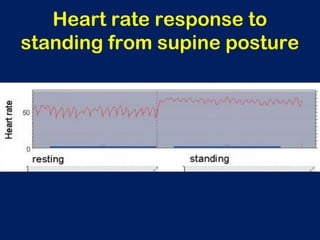 Heart rate response to
standing from supine posture
 