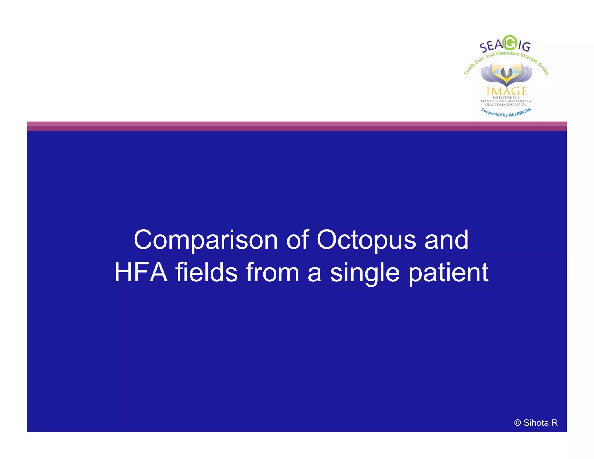 Comparison of Octopus and
HFA fields from a single patient
© Sihota R
 