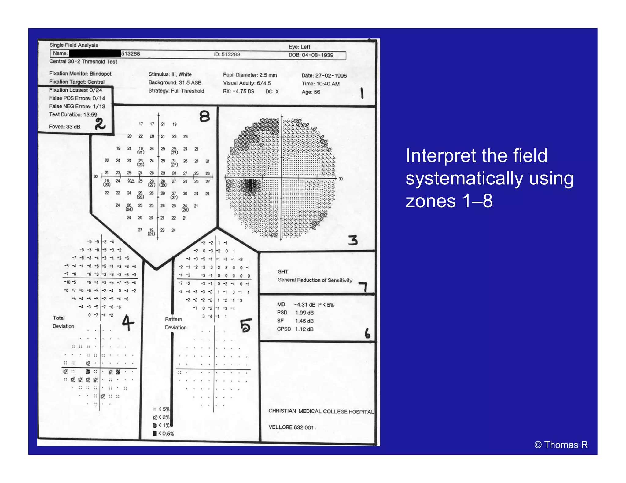 Interpret the field
systematically using
zones 1–8
© Thomas R
 