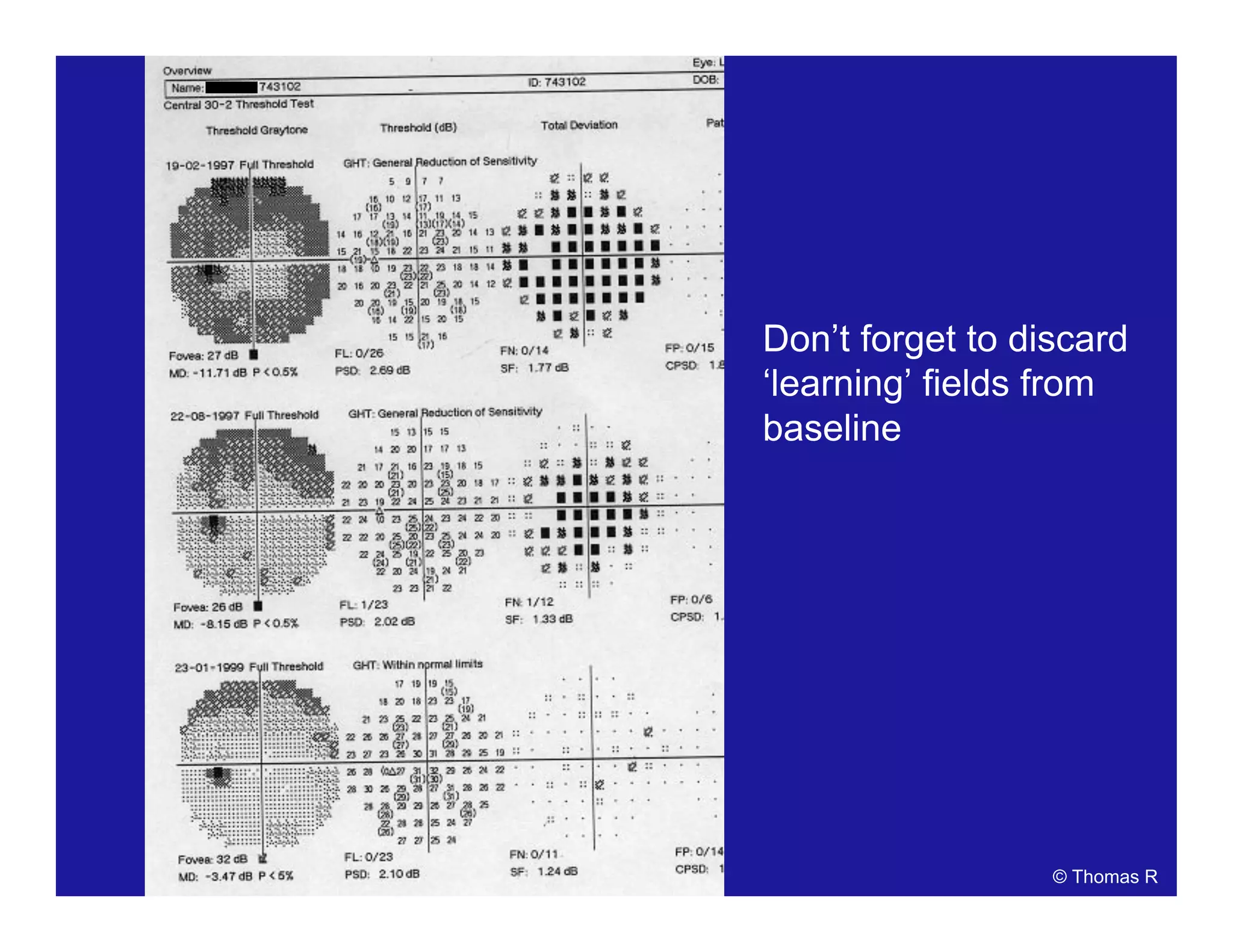 Don’t forget to discard
‘learning’ fields from
baseline
© Thomas R
 