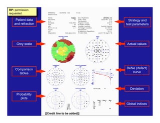 [[Credit line to be added]]
Probability
plots
Comparison
tables
Grey scale
Patient data
and refraction
Strategy and
test parameters
Actual values
Bebie (defect)
curve
Deviation
Global indices
RP: permission
requested
 