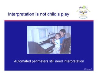 © Thomas R
Interpretation is not child’s play
Automated perimeters still need interpretation
 