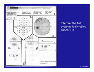 Interpret the field
systematically using
zones 1–8
© Thomas R
 