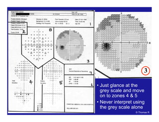 • Just glance at the
grey scale and move
on to zones 4 & 5
• Never interpret using
the grey scale alone
3
© Thomas R
 
