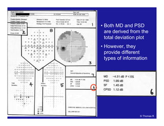 • Both MD and PSD
are derived from the
total deviation plot
• However, they
provide different
types of information
© Thomas R
 
