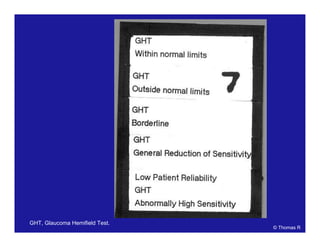 © Thomas R
GHT, Glaucoma Hemifield Test.
 