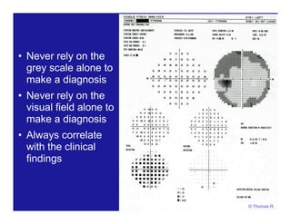• Never rely on the
grey scale alone to
make a diagnosis
• Never rely on the
visual field alone to
make a diagnosis
• Always correlate
with the clinical
findings
© Thomas R
 