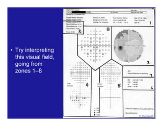• Try interpreting
this visual field,
going from
zones 1–8
© Thomas R
 