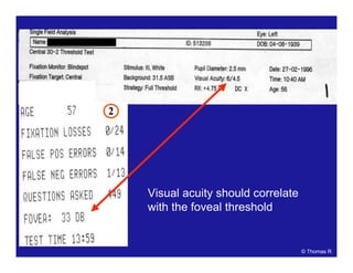 2
2
Visual acuity should correlate
with the foveal threshold
© Thomas R
 
