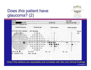 © Thomas R
Does this patient have
glaucoma? (2)
Only if the defects are repeatable and correlate with disc and clinical findings
 