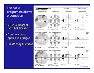 © Thomas R
Overview
programme shows
progression
• SITA is different
from full threshold
• Can't compare
apples to oranges
• Fields may fluctuate
 
