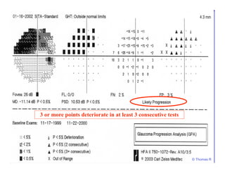 3 or more points deteriorate in at least 3 consecutive tests
© Thomas R
 