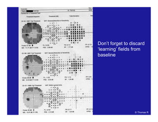 Don’t forget to discard
‘learning’ fields from
baseline
© Thomas R
 