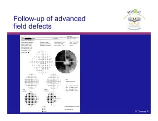 © Thomas R
Follow-up of advanced
field defects
 