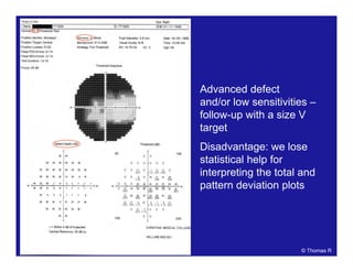 Advanced defect
and/or low sensitivities –
follow-up with a size V
target
Disadvantage: we lose
statistical help for
interpreting the total and
pattern deviation plots
© Thomas R
 