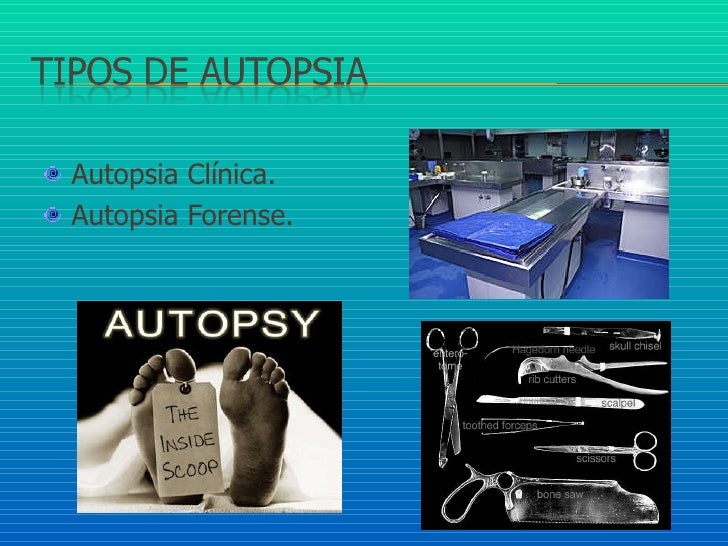 Autopsia