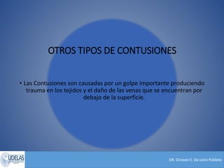 DR. Octavio E. De León Poblete
OTROS TIPOS DE CONTUSIONES
• Las Contusiones son causadas por un golpe importante produciendo
trauma en los tejidos y el daño de las venas que se encuentran por
debajo de la superficie.
 