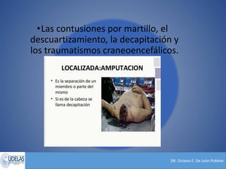 DR. Octavio E. De León Poblete
•Las contusiones por martillo, el
descuartizamiento, la decapitación y
los traumatismos craneoencefálicos.
 