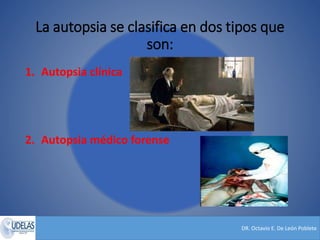 DR. Octavio E. De León Poblete
La autopsia se clasifica en dos tipos que
son:
1. Autopsia clínica
2. Autopsia médico forense
 