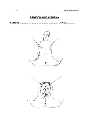 PROTOCOLO DE AUTOPSIA
NOMBRE………………………………………………… CASO ………...
92 JORGE NÚÑEZ DE ARCO
 