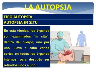 LA AUTOPSIA
TIPO AUTOPSIA
AUTOPSIA IN SITU
En esta técnica, los órganos
son examinados “in situ”,
dentro del cuerpo, uno por
uno. Lleva a cabo varios
cortes en todos los órganos
internos, para después ser
retirados unos a uno..
 