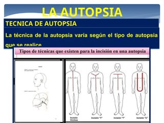 LA AUTOPSIA
TECNICA DE AUTOPSIA
La técnica de la autopsia varía según el tipo de autopsia
que se realice.
 