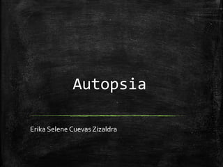 Autopsia
Erika Selene Cuevas Zizaldra
 