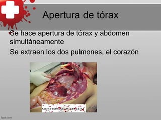 Apertura de tórax
Se hace apertura de tórax y abdomen
simultáneamente
Se extraen los dos pulmones, el corazón
 