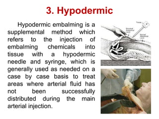 Split Injection Embalming Autopsy, embalming, care of dead body | PDF
