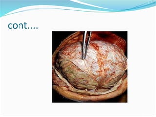 Autopsy lecture final(1).pdf for medical students | PDF