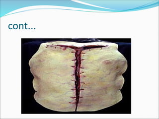 Autopsy lecture final(1).pdf for medical students | PDF