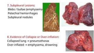 Autopsy of lung.pptx important topic for pathology pgs and everyone | PPTX