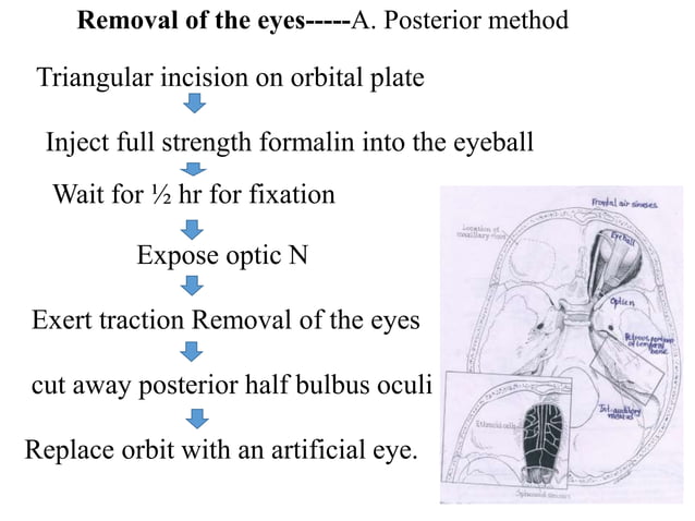 Autopsy techniques.ppt