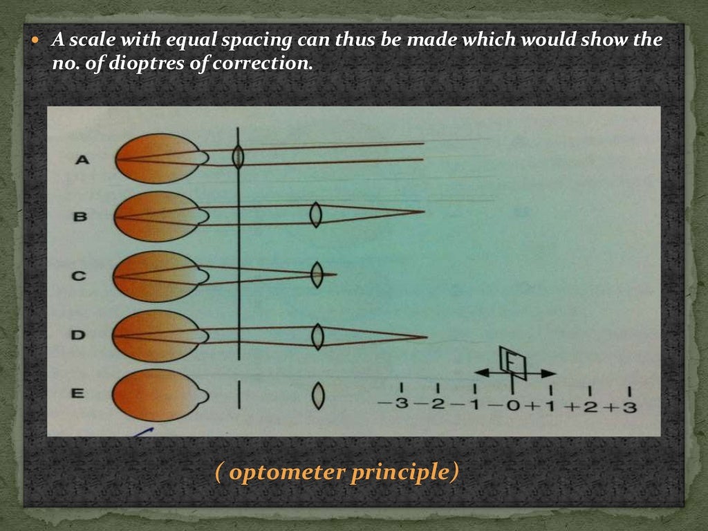Autorefractometry principle and procedure.