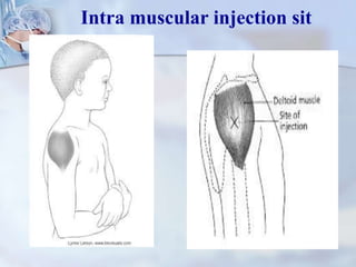 Intra muscular injection sit
 