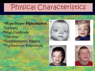 Physical Characteristics

*Hypo/Hyper Pigmentation
*Epilepsy
*High Foreheads
*Flat nose
*Supernumerary Nipples
*Psychomotor Retardation
 