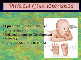Physical Characteristics


*Epicanthal Folds in the Eye
*Short Stature
*Delayed Language Development
*Seizures
*Some are Mentally Retarded
 